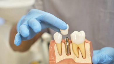 who-is-a-good-candidate-for-dental-implants?